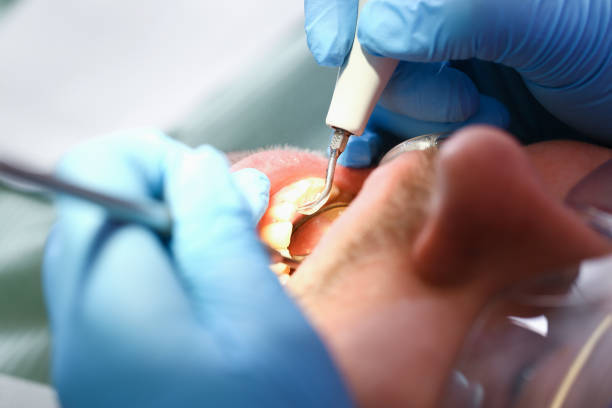 Best Broken or Cracked Tooth Emergency Dentist in Franklin, PA