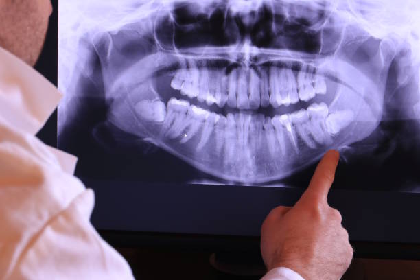 Best Pediatric Emergency Dentist in Franklin, PA